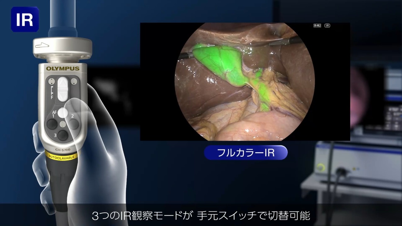動画でわかる腹腔鏡下胆嚢摘出術 : 基本から技術認定まで 動画でわかる腹腔鏡下胆嚢摘出術: 基本から技術認定まで 動画で